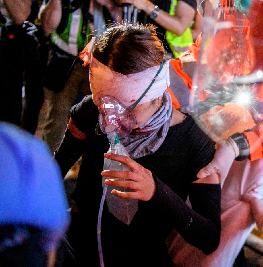 응급처치 참여 저조